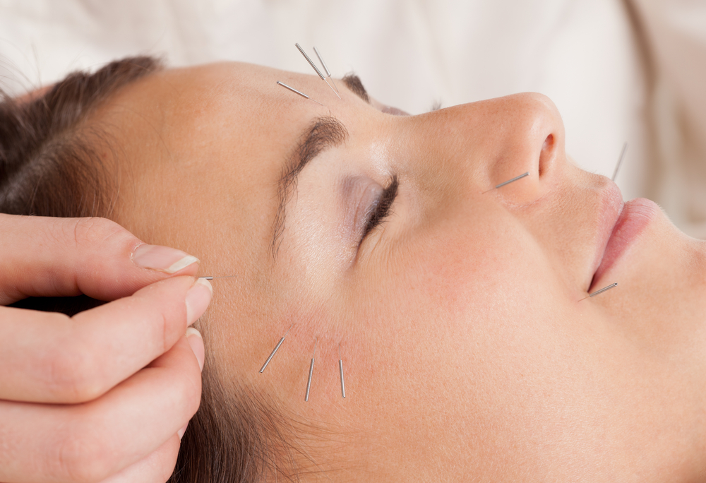 Discover the Ancient Art of Rejuvenation with Facial Acupuncture